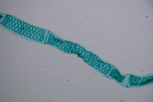 Spirogyra 10×