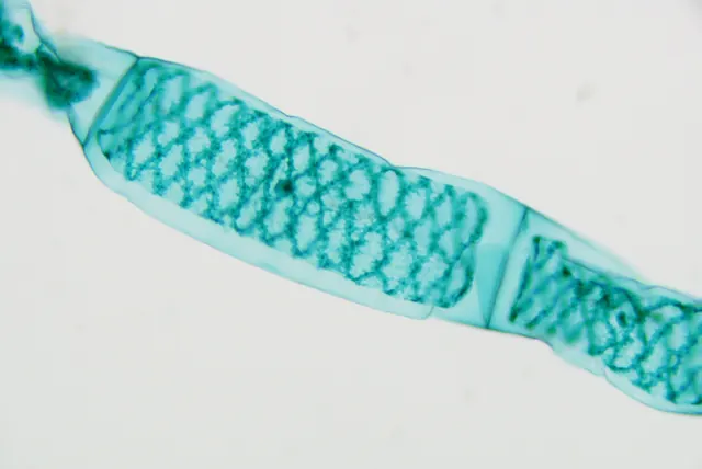 Spirogyra 20×