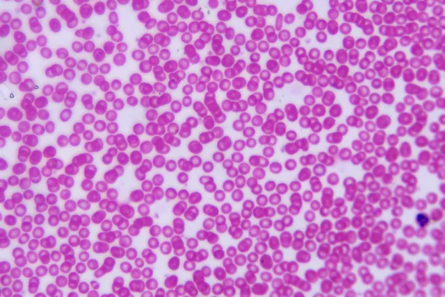 Human Blood 50×
