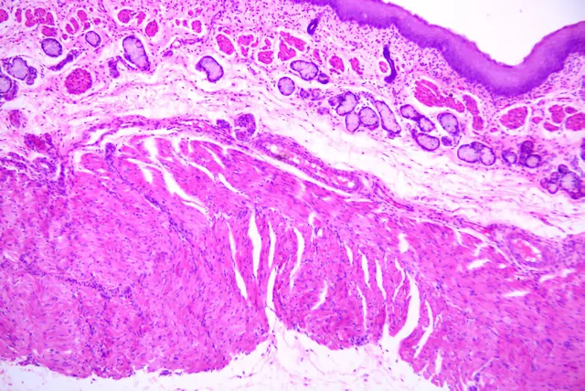 Oesophagus 10×