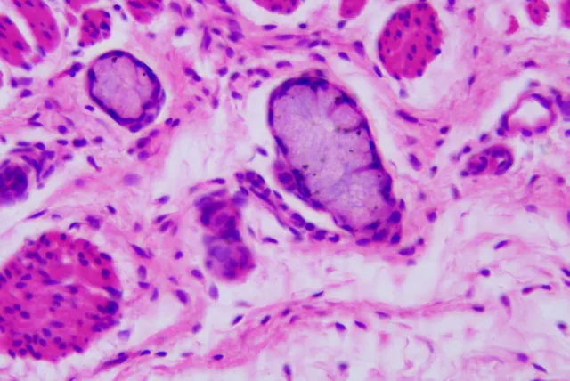 Oesophagus 50×